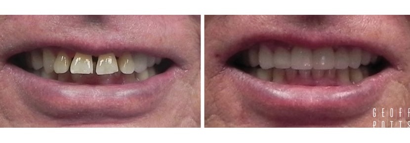 Patient before and After photo 3