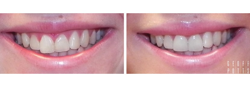 Patient before and After photo 4
