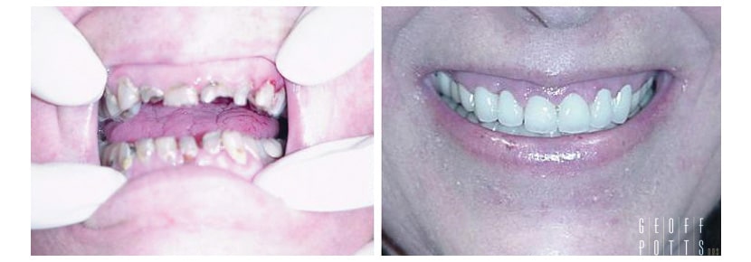Patient before and After photo 11