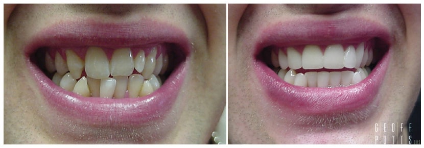 Patient before and After photo 12