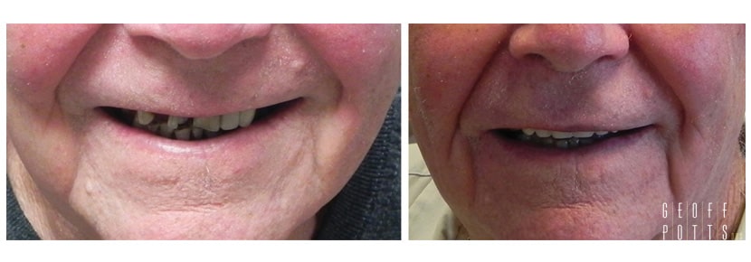 Patient before and After photo 9